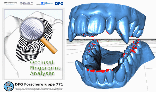 occlusal-fingerprint-analyser_for771.png